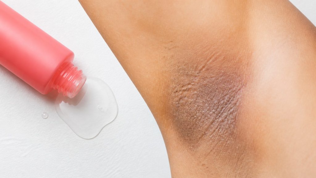 Isolating the visible problem signal in topic-specific evidence area for glycolic acid not working on underarms